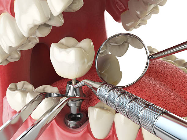 Best Emergency Treatment for Toothache in Westmoreland, TN