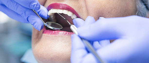 Best Emergency Wisdom Teeth Removal in Westmoreland, TN
